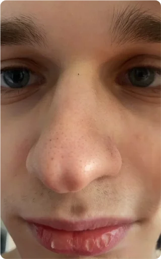 person human face eyelash