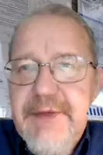 person human face forehead