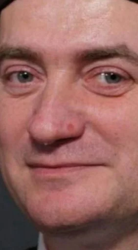 human face person forehead