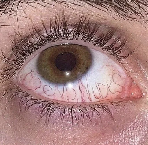 Стикер форг скатился - 0