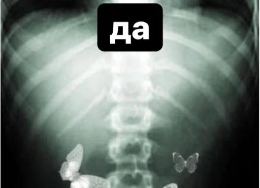 x-ray film text medical imaging