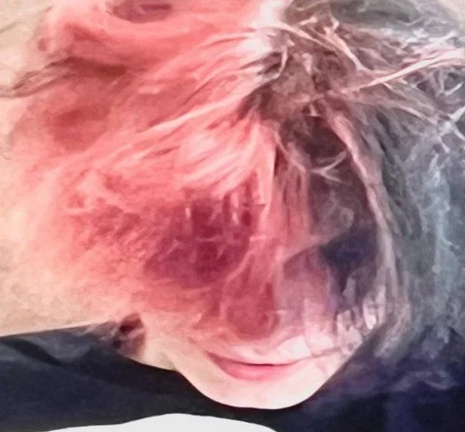 Человек кожа щека